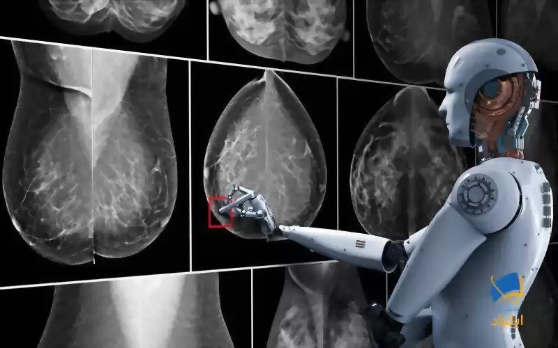 دقت بالای هوش‌مصنوعی در تشخیص سرطان سینه