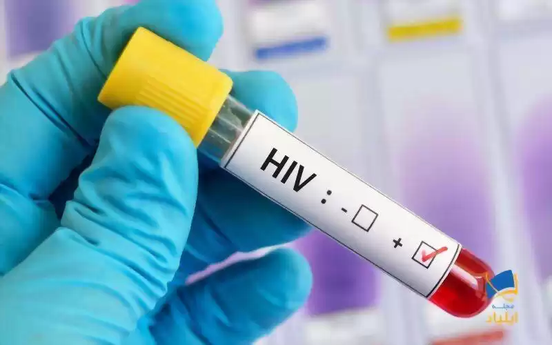 دومین بیمار مبتلا به HIV چگونه درمان شد؟