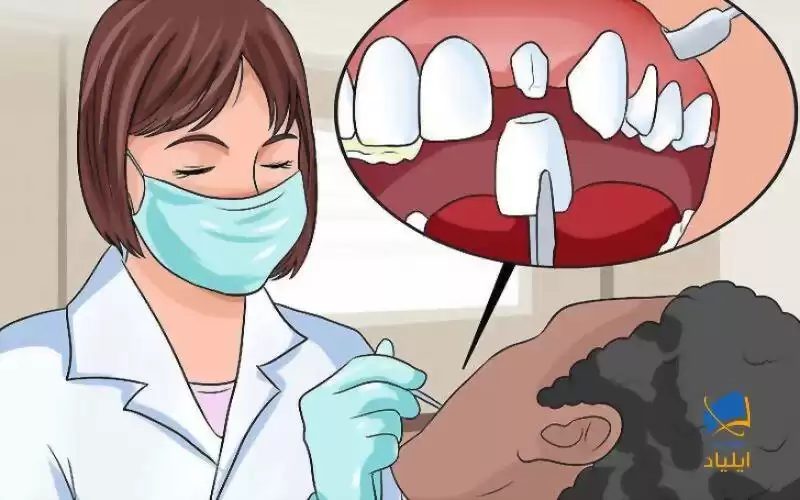 در مورد گزینه‌های ترمیم با یک دندانپزشک مشورت کنید