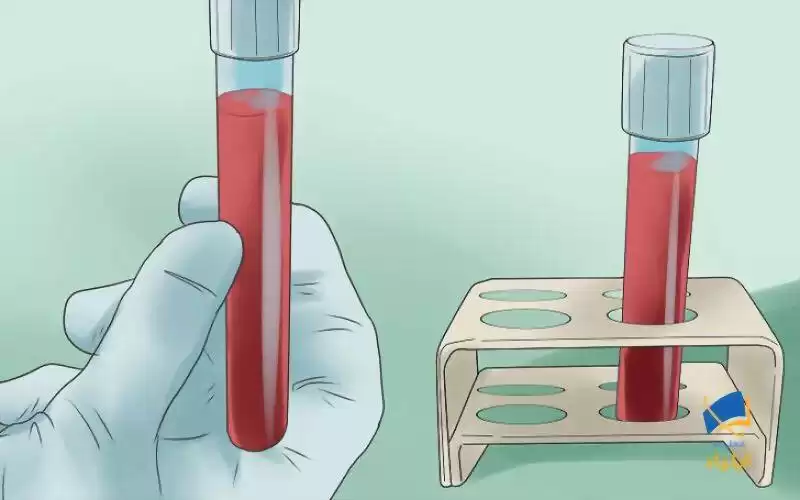 انجام آزمایشات تشخیصی برای تعیین نوع کم خونی