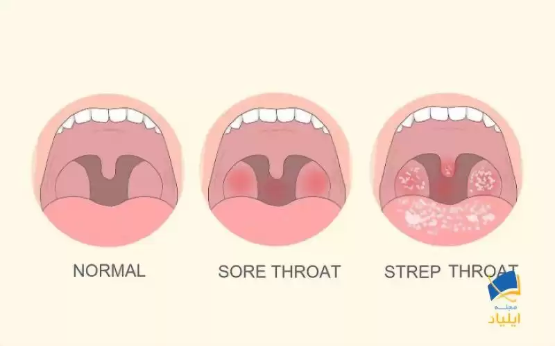 بررسی علائم گلو و دهان
