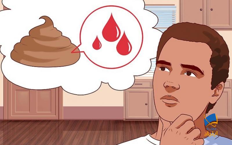 شناخت علائم کولیت اولسروز