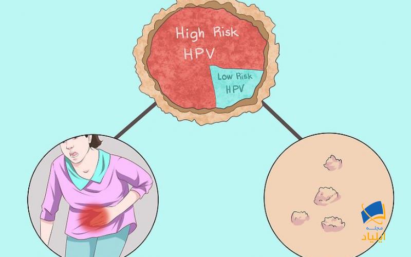 تشخیص HPV