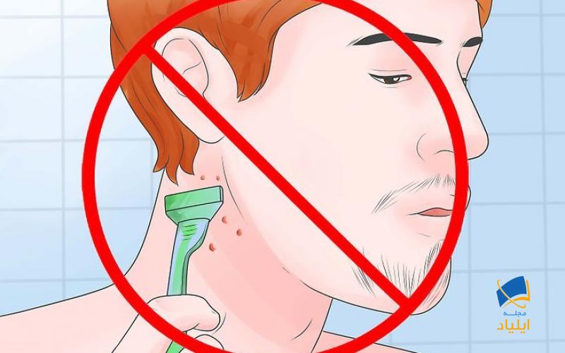 پرهیز از رفتارهای مولد فولیکولیت