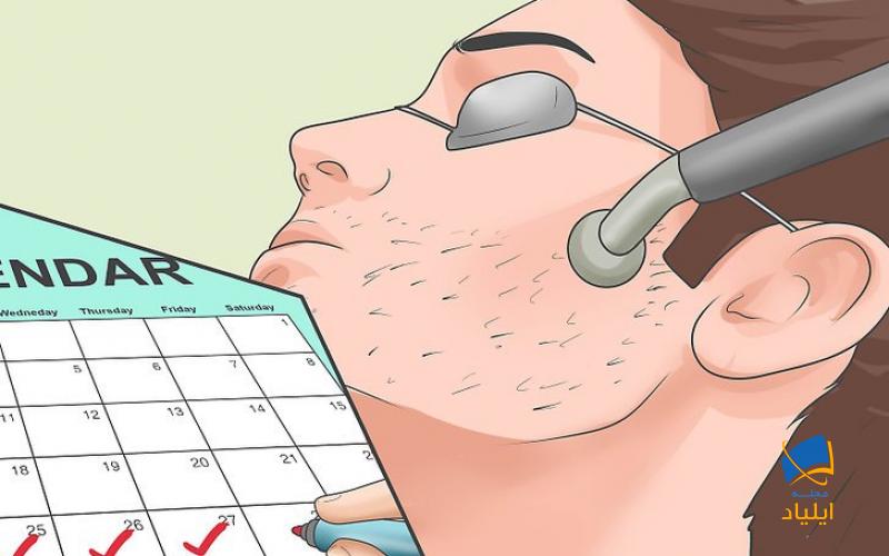 انجام لیزر موهای زائد