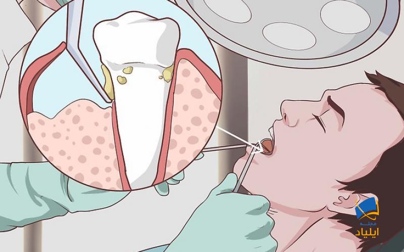 درمانهای پیشرفته بیماری