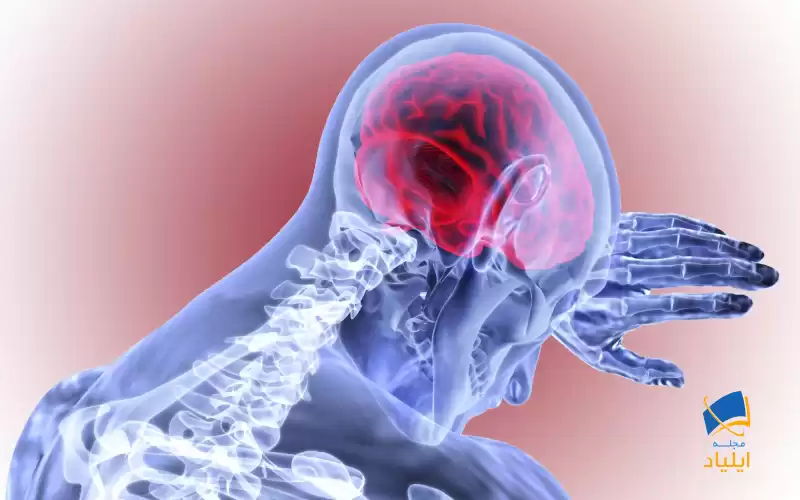 چگونه خطر سکته مغزی را کاهش دهیم؟