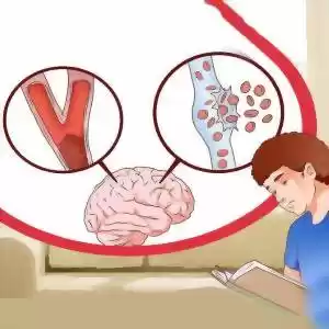 چگونه علا‌ئم سکته مغزی را تشخیص دهیم؟
