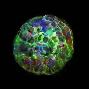 راهی برای تبدیل سلول‌های سرطانی به چربی!
