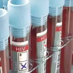 دومین درمان موفق بیمار مبتلا به ایدز