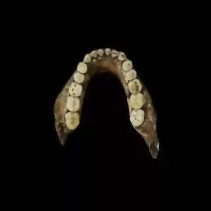 چرا جنس دندان‌های انسان‌های باستانی بهتر بوده است؟ 