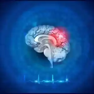 ارتباط آلزایمر و زوال عقل با مرگ ناشی از سکته‌ی مغزی