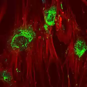 تبدیل سلول‌های بنیادی به سلول‌های استخوانی