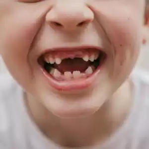 داستان افتادن دندان‌ها در انسان‌